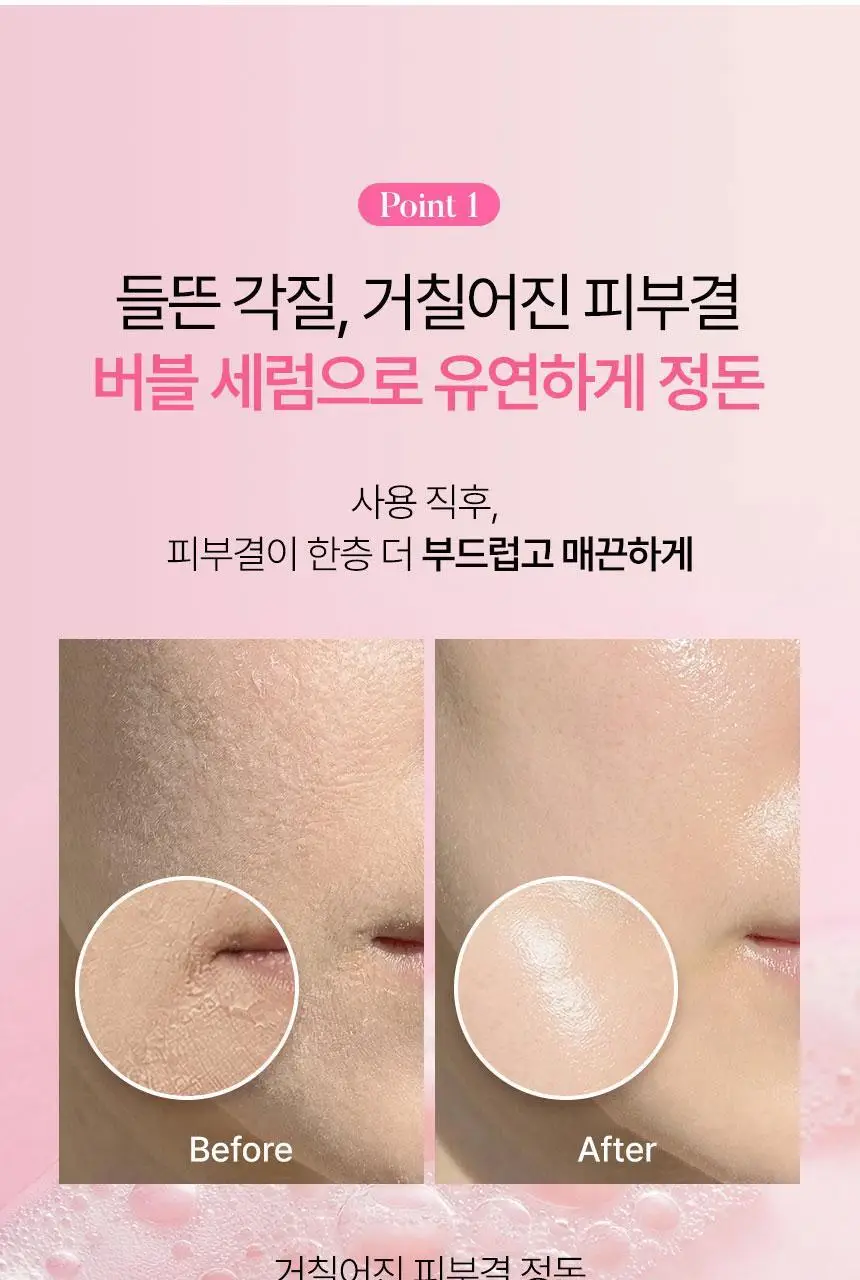 [화잘먹/속광부스터] 샤이샤이샤이 리페어 밀키 우레아 글로우 버블 세럼 110ml 기획 (+ 밀키크림 15ml) 상세페이지 25